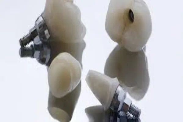 What Are the Benefits of Using Zirconia Abutments, and In What Situations Are They Most Suitable?