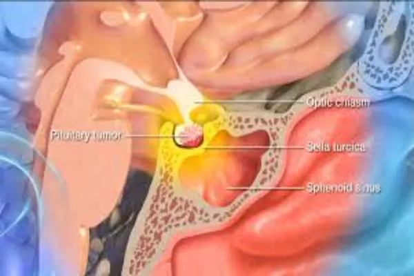 What are the most visible signs of HGH deficiency?