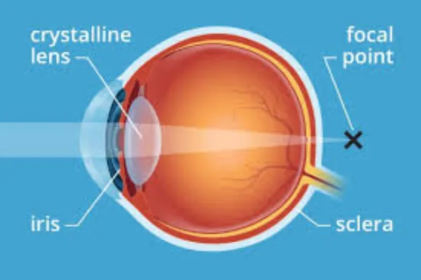 Presbyopic Eye Challenges After 40: Signs You Might Notice First