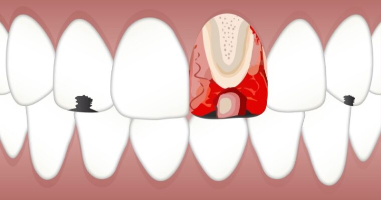 How to Address Minor Tooth Damage Without Extensive Dental Surgery
